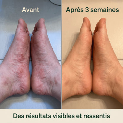 Retrouvez le sommeil que vous aviez perdu